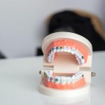 Co ortodonta robi na wizytach kontrolnych?