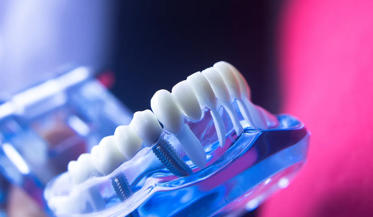 Endodoncja Szczecin