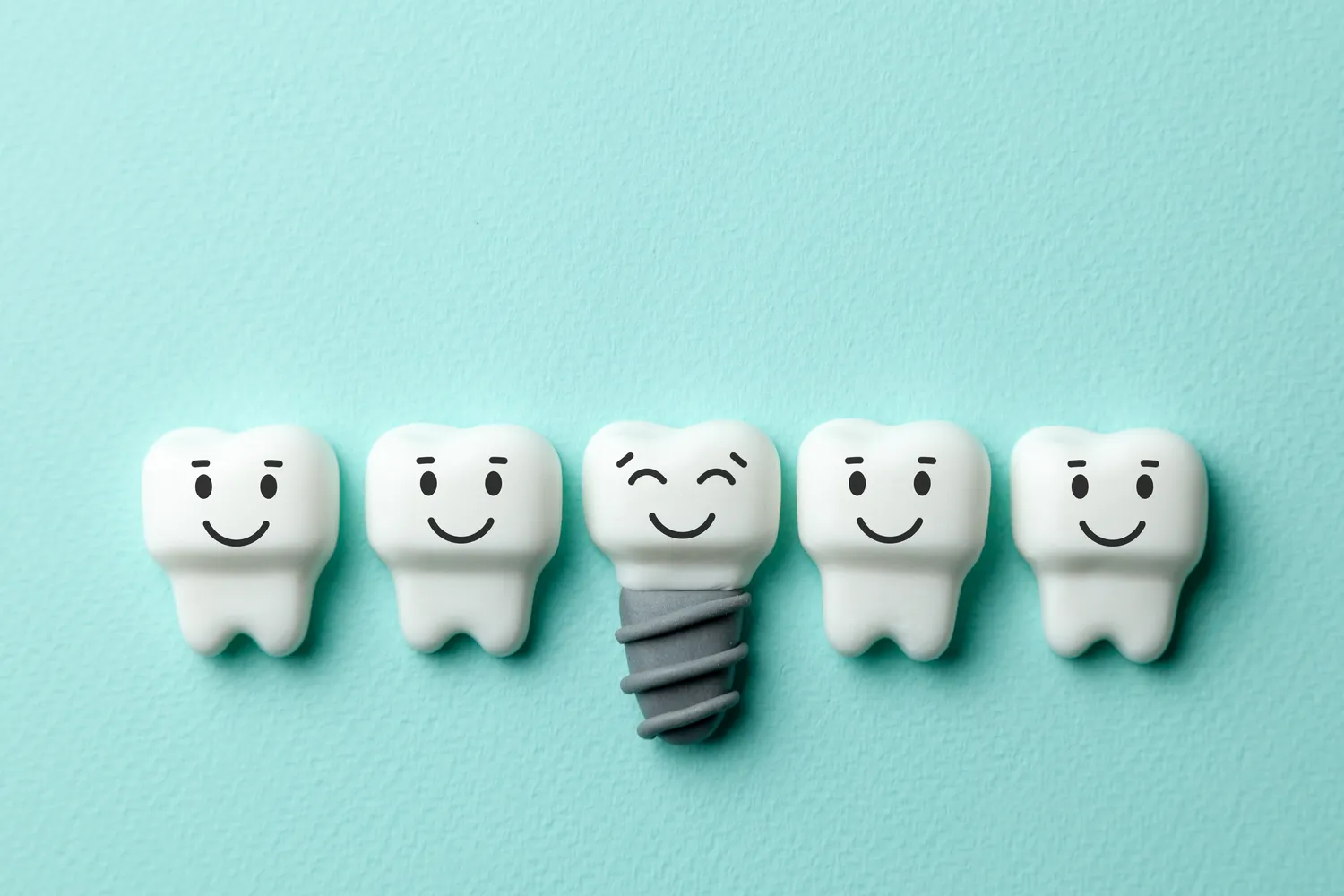 Implanty zębowe rodzaje - najważniejsze informacje